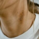 tan removal techniques for neck